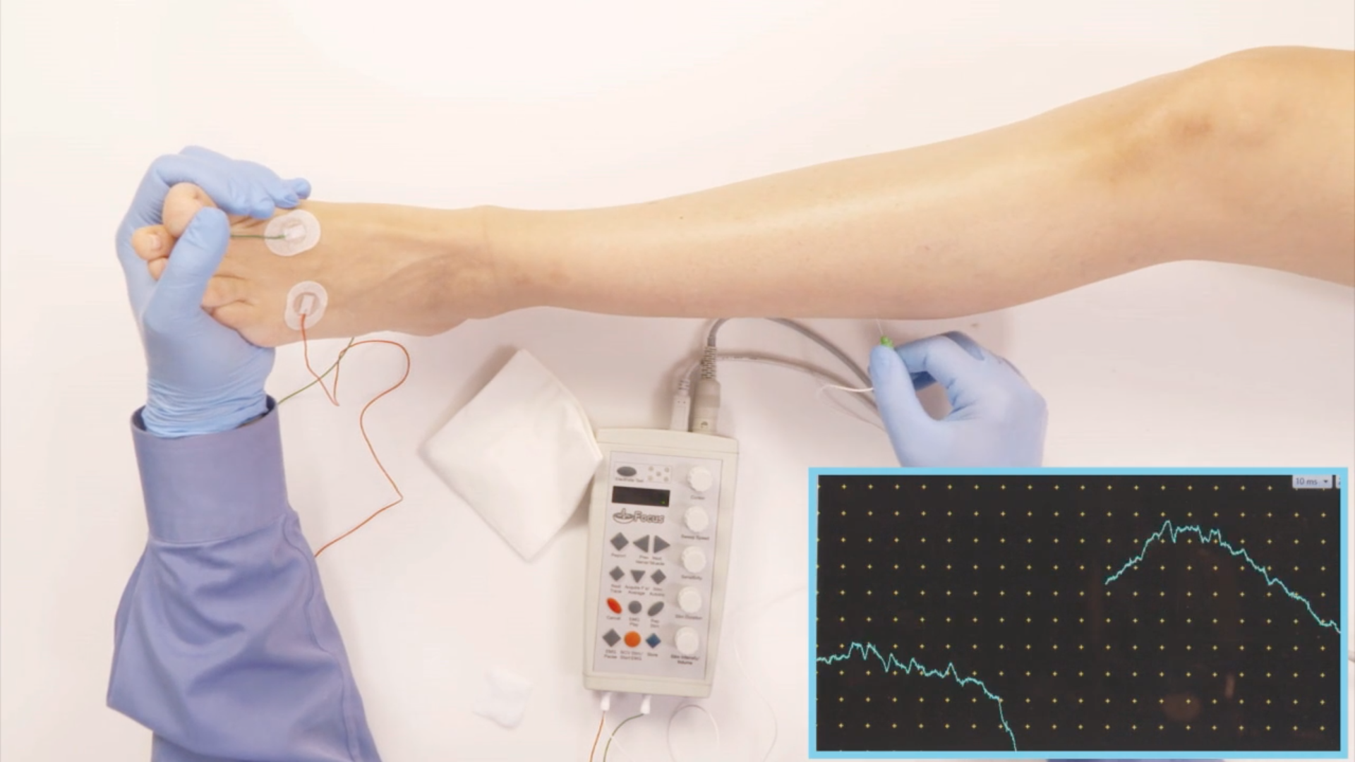 Medical Nerve Conduction—video Training Series Corporate Video